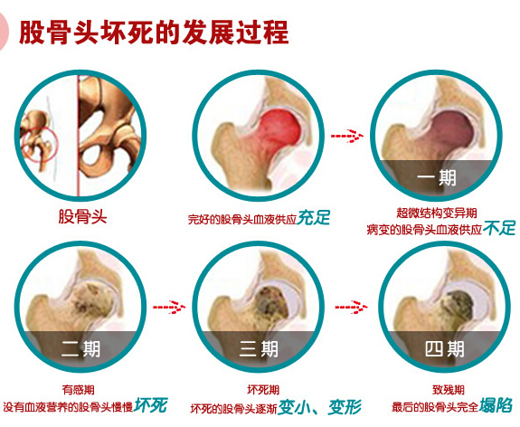 病变过程.jpg