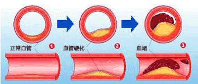 病变过程标题.jpg