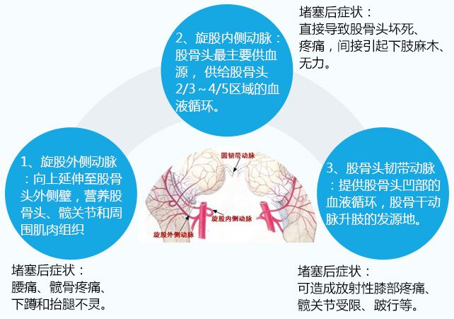 沈阳专业治疗股骨头坏死的医院